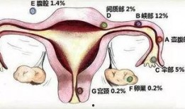 深圳宫外孕爆料新闻报道